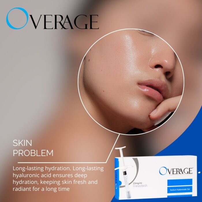 https://www.mesotech.it/products/overage-pre-filled-hyaluronic-acid-syringe-dermafiller/